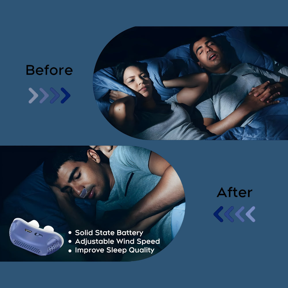 Anti Snoring Device Nasal Sleep Aid Silicone Breathing Support