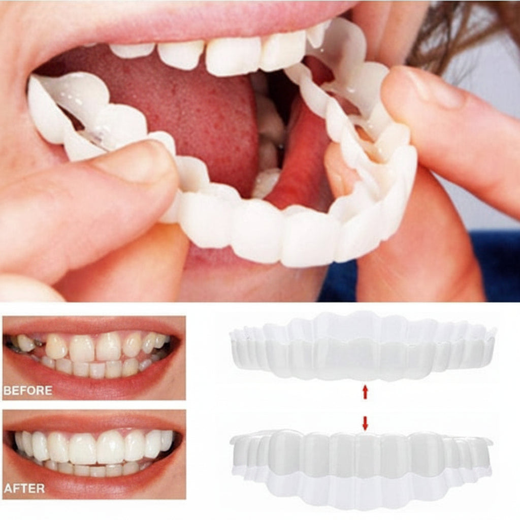 Affordable Smile Veneers Removable Teeth Veneers Natural Looking