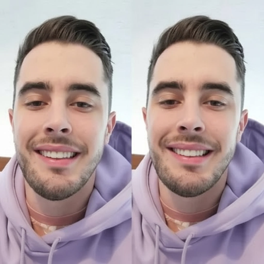 Affordable Smile Veneers Removable Teeth Veneers Natural Looking